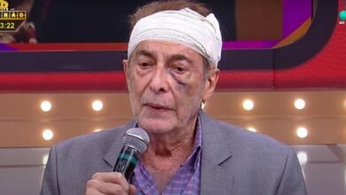 Espancado em casa Ronaldo Esper detalha agressao em forte relato