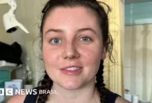 Jovem que sofreu AVC aos 26 anos relata superação e mudança de vida 37 Jovem sorrindo em área externa