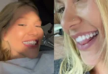 Joia nos dentes: dentista alerta sobre riscos da tendência entre famosos 6 Ilustração de dentes decorados com pedras brilhantes