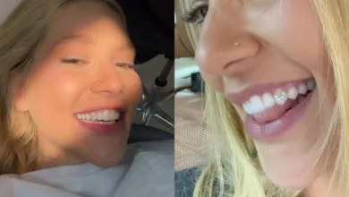 Joia nos dentes: dentista alerta sobre riscos da tendência entre famosos 3 Ilustração de dentes decorados com pedras brilhantes