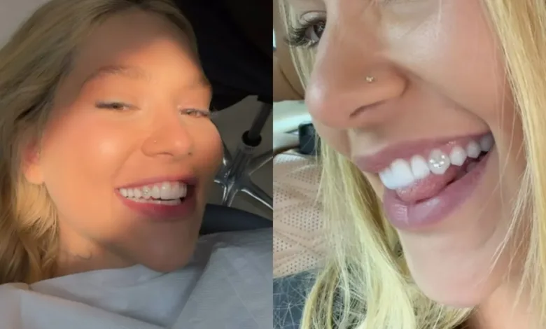 Ilustração de dentes decorados com pedras brilhantes